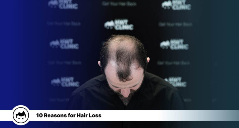 10 Reasons for Hair Loss