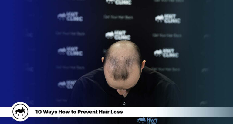 Hair Loss Prevention Tips