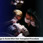 19 Things to Avoid After Hair Transplant Procedure