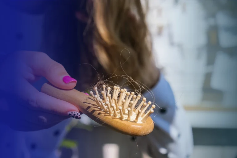 about female pattern baldness