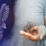 Causas de la caída del cabello