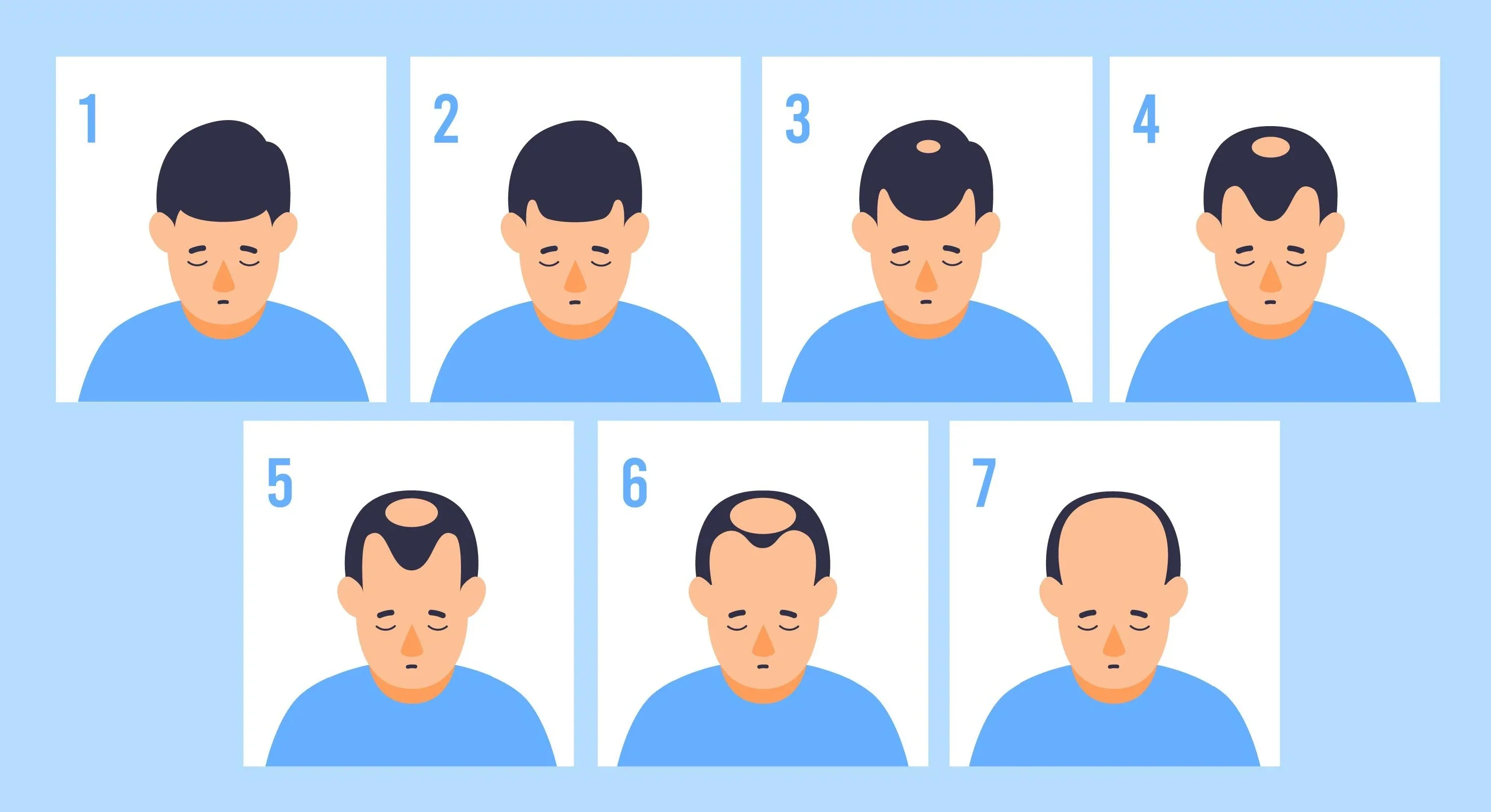 What are the stages of hair loss?