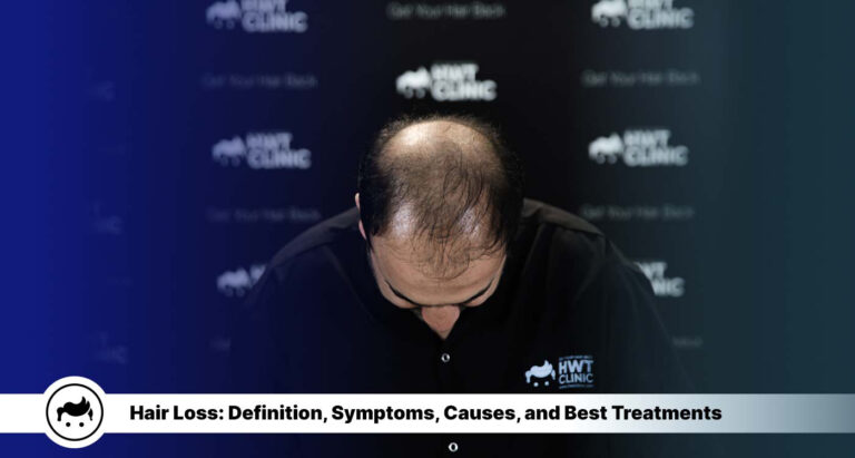 Hair Loss: Definition, Symptoms, Causes, and Best Treatments