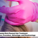 PRP (Platelet Rich Plasma) Hair Treatment: Definition, Procedure, Advantage, and Disadvantage