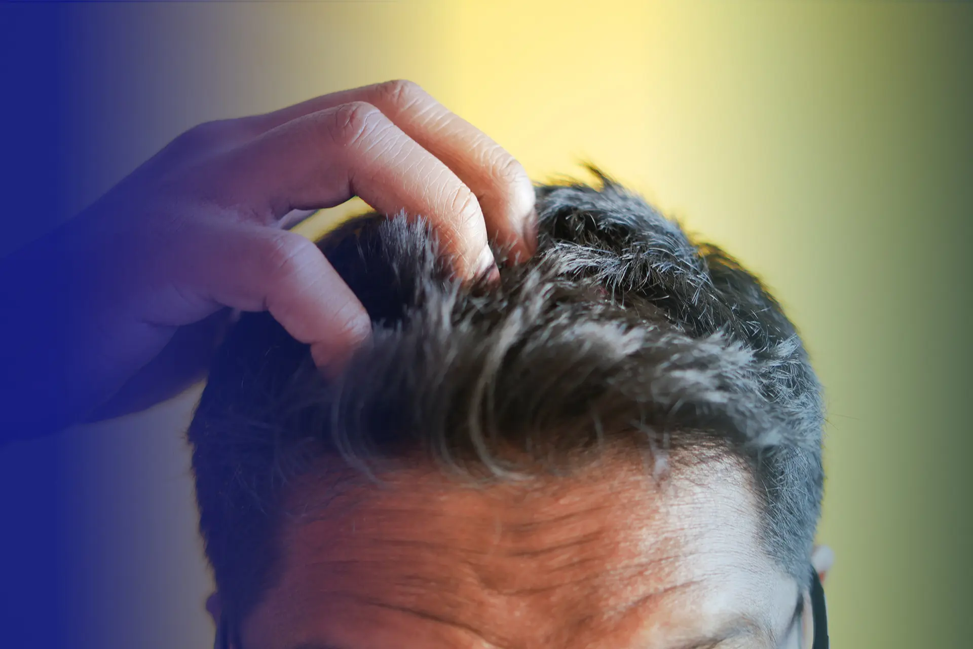 c-mo-detener-el-cabello-graso-blog-de-la-cl-nica-hwt