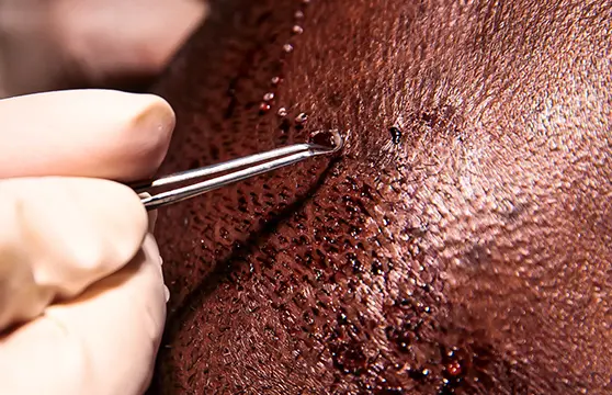 What is Afro-Textured Hair?