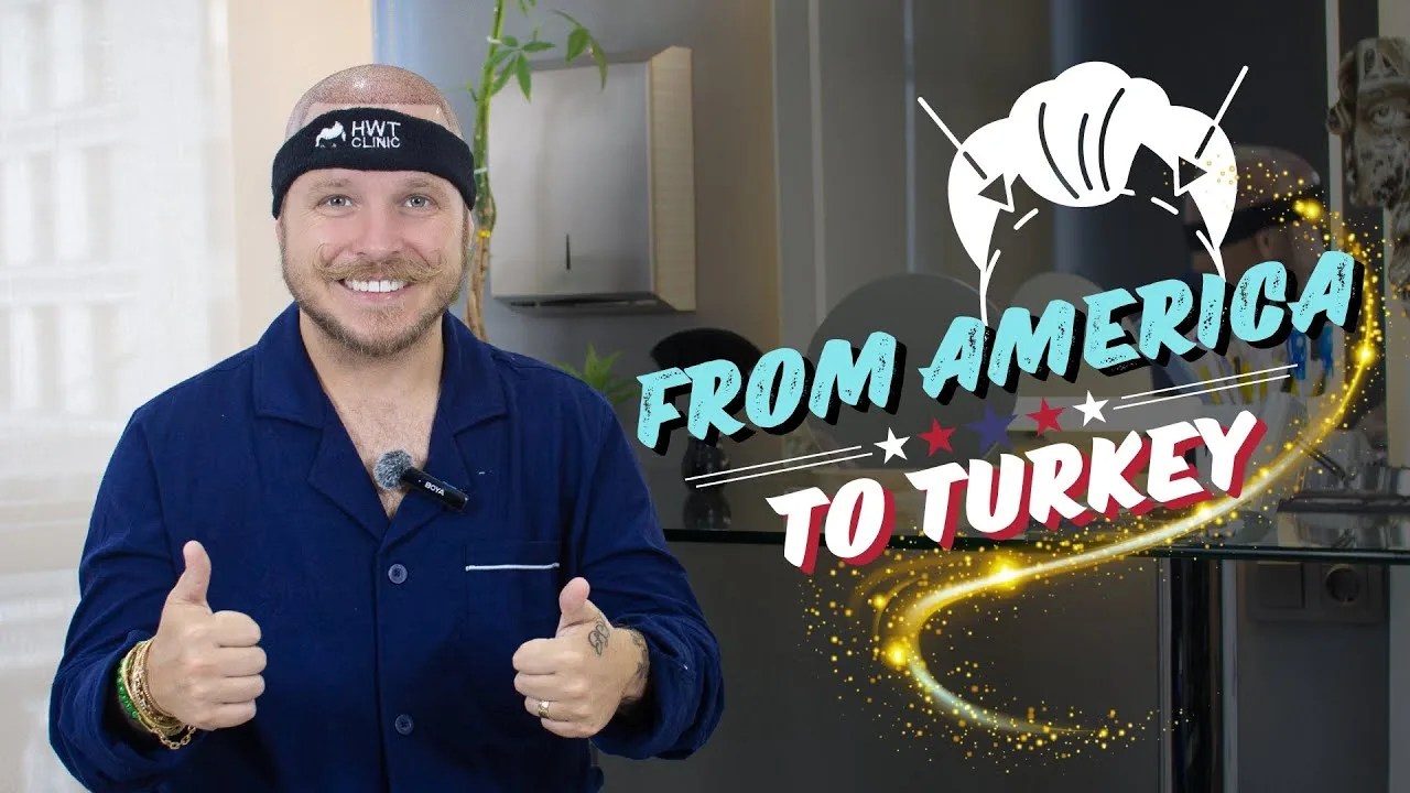 hair transplant results video journey in Turkey - HWT Clinic