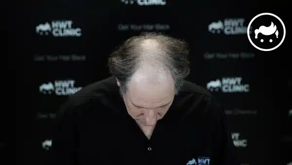 Who is Hair Transplant for?
