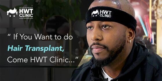 FUE-Haartransplantations erfahrung mit HWT Clinic