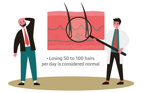 Quelques données sur la perte de cheveux
